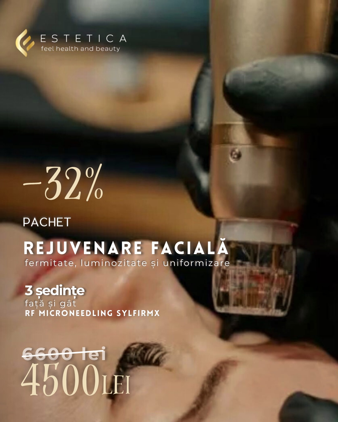 Oferte 17 tratament rejuvenare faciala 3 sedinte RF SylfirmX
