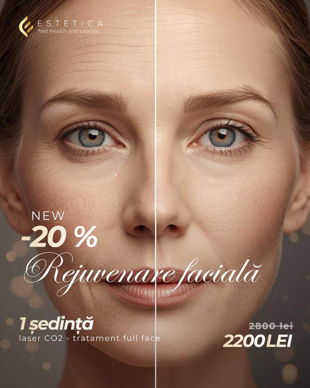 Home 4 Rejuvenare faciala cu laser CO2 pentru netezirea ridurilor